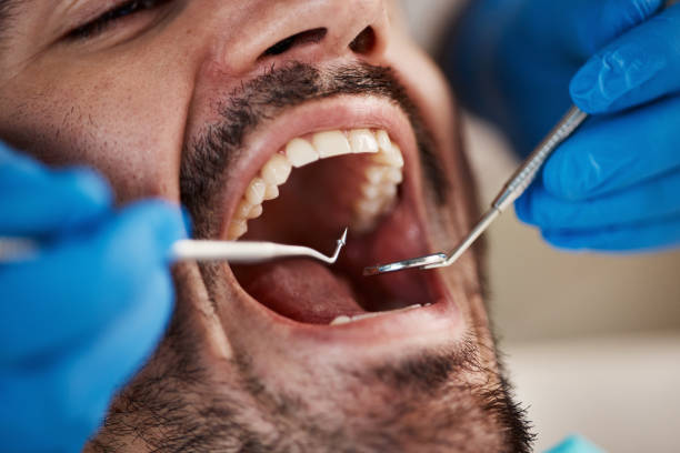 Best Emergency Dental Care for Broken or Chipped Teeth in Forest Lake, IL