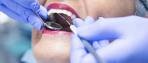 Best Emergency Tooth Extraction in Forest Lake, IL